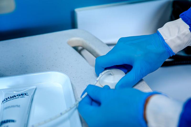 Monitoreo de pH con Impedancia – Hospital CYNTAR Tijuana
